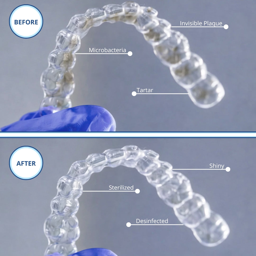 Novasmile™ Ultrasonic Cleaner