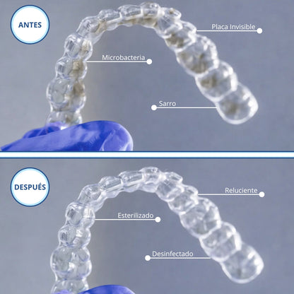 Novasmile™ Limpiador Ultrasónico Retenedores